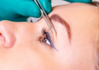 Non-surgical Blepharoplasty